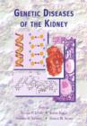 Genetic Diseases of the Kidney - eBook