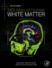 MRI Atlas of Human White Matter - eBook
