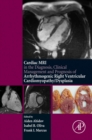 Cardiac MRI in Diagnosis, Clinical Management, and Prognosis of Arrhythmogenic Right Ventricular Cardiomyopathy/Dysplasia - eBook
