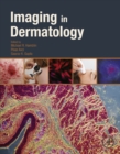 Imaging in Dermatology - eBook