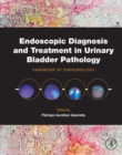 Endoscopic Diagnosis and Treatment in Urinary Bladder Pathology : Handbook of Endourology - eBook