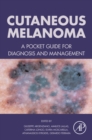 Cutaneous Melanoma : A Pocket Guide for Diagnosis and Management - eBook