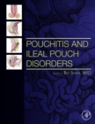 Pouchitis and Ileal Pouch Disorders : A Multidisciplinary Approach for Diagnosis and Management - eBook