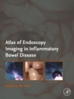Atlas of Endoscopy Imaging in Inflammatory Bowel Disease - eBook