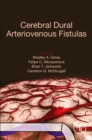 Cerebral Dural Arteriovenous Fistulas - Book
