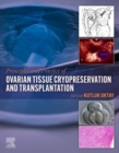 Principles and Practice of Ovarian Tissue Cryopreservation and Transplantation - eBook