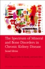The Spectrum of Mineral and Bone Disorders in Chronic Kidney Disease - eBook