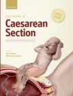 Textbook of Caesarean Section - eBook