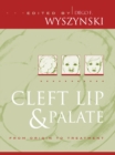 Cleft Lip and Palate : From Origin to Treatment - eBook