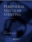 Peripheral Vascular Stenting - eBook