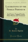 Lacerations of the Female Perineum : And Vesico-Vaginal Fistula; Their History and Treatment - eBook
