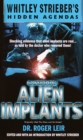 Casebook: Alien Implants - eBook