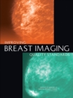 Improving Breast Imaging Quality Standards - eBook
