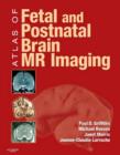 Atlas of Fetal and Postnatal Brain MR - eBook