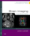 Brain Imaging: Case Review Series : Brain Imaging: Case Review Series E-Book - eBook