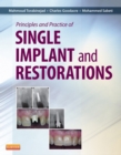 Principles and Practice of Single Implant and Restoration - eBook
