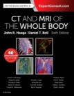 CT and MRI of the Whole Body - eBook