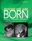 Before We Are Born E-Book : Essentials of Embryology and Birth Defects With STUDENT CONSULT Online Access - eBook