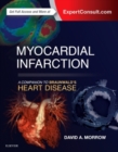 Myocardial Infarction: A Companion to Braunwald's Heart Disease - Book