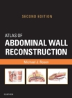 Atlas of Abdominal Wall Reconstruction E-Book : Atlas of Abdominal Wall Reconstruction E-Book - eBook