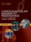 Cardiovascular Magnetic Resonance : A Companion to Braunwald's Heart Disease E-Book - eBook