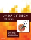 Lumbar Interbody Fusions - eBook