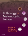 Pathology of Melanocytic Tumors E-Book - eBook