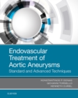 Endovascular Treatment of Aortic Aneurysms : Standard and Advanced Techniques - eBook