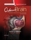 Osborn's Brain : Osborn's Brain E-Book - eBook