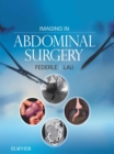 Imaging in Abdominal Surgery E-Book - eBook