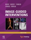 Image-Guided Interventions E-Book : Expert Radiology Series - eBook