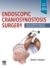 Endoscopic Craniosynostosis Surgery E-Book : An Illustrated Guide to Endoscopic Techniques - eBook