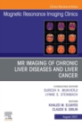 MR Imaging of Chronic Liver Diseases and Liver Cancer, An Issue of Magnetic Resonance Imaging Clinics of North America, E-Book : MR Imaging of Chronic Liver Diseases and Liver Cancer, An Issue of Magn - eBook