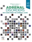 Adrenal Disorders,E-Book : Cases from the Adrenal Clinic - eBook