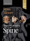 Diagnostic Imaging: Spine : Diagnostic Imaging: Spine - E-Book - eBook