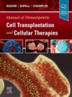 Manual of Hematopoietic Cell Transplantation and Cellular Therapies - eBook