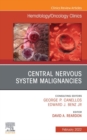 Central Nervous System Malignancies, An Issue of Hematology/Oncology Clinics of North America, E-Book - eBook