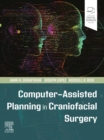 Computer-Assisted Planning in Craniofacial Surgery - eBook