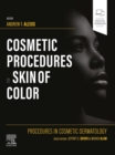 Procedures in Cosmetic Dermatology: Cosmetic Procedures in Skin of Color - E-Book - eBook