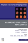 MR Imaging of Head and Neck Cancer, An Issue of Magnetic Resonance Imaging Clinics of North America, E-Book : MR Imaging of Head and Neck Cancer, An Issue of Magnetic Resonance Imaging Clinics of Nort - eBook