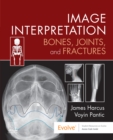 Image Interpretation: Bones, Joints, and Fractures - E-Book : Image Interpretation: Bones, Joints, and Fractures - E-Book - eBook