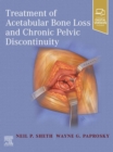 Treatment of Acetabular Bone Loss and Chronic Pelvic Discontinuity - eBook