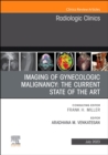 Imaging of Gynecologic Malignancy: The Current State of the Art, An Issue of Radiologic Clinics of North America : Volume 61-4 - Book