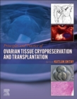 Principles and Practice of Ovarian Tissue Cryopreservation and Transplantation - Book
