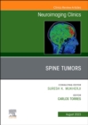 MRI and Traumatic Brain Injury, An Issue of Neuroimaging Clinics of North America : Volume 33-2 - Book