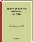 Tumors of the Fetus and Infant : An Atlas - eBook