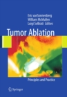 Tumor Ablation : Principles and Practice - eBook