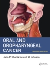 Oral and Oropharyngeal Cancer - eBook