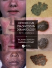 Differential Diagnosis in Dermatology - eBook