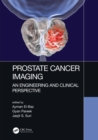 Prostate Cancer Imaging : An Engineering and Clinical Perspective - eBook